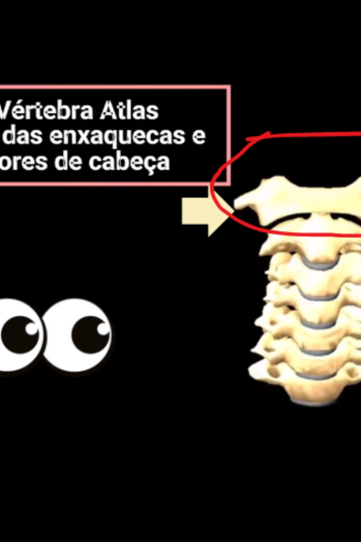 Enxaqueca e Vértebra Atlas