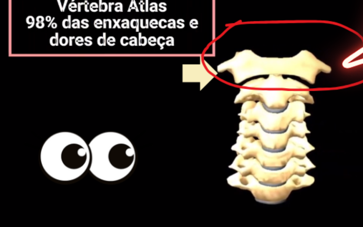 Enxaqueca e Vértebra Atlas